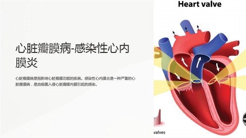 心脏瓣膜病-感染性心内膜炎