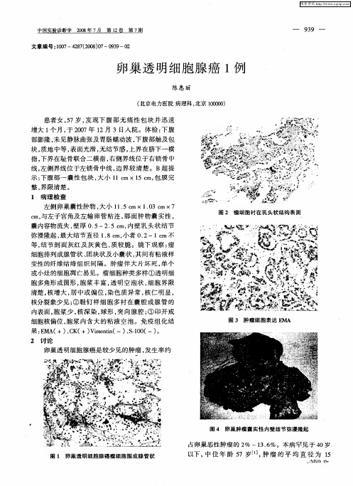 卵巢透明细胞腺癌1例