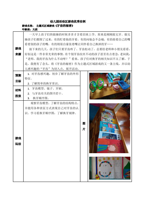 幼儿园大班活动区游戏优秀教学案例：《牙齿的秘密》