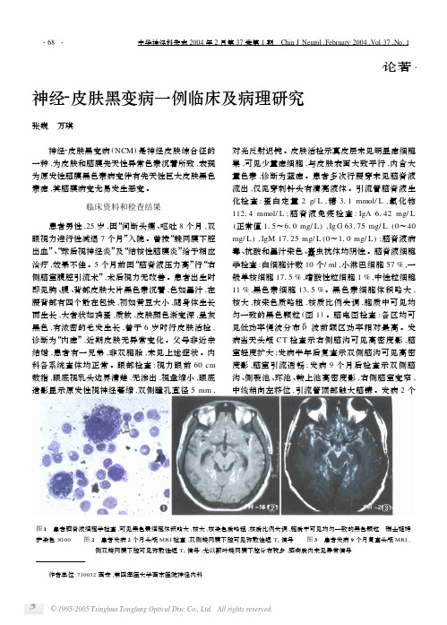 神经-皮肤黑变病一例临床及病理研究