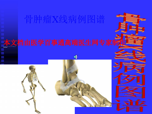 骨肿瘤X线病历图谱