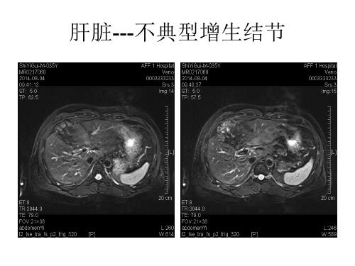 医学影像-病例读片