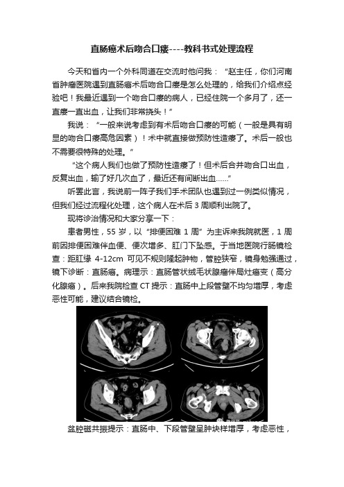 直肠癌术后吻合口瘘----教科书式处理流程