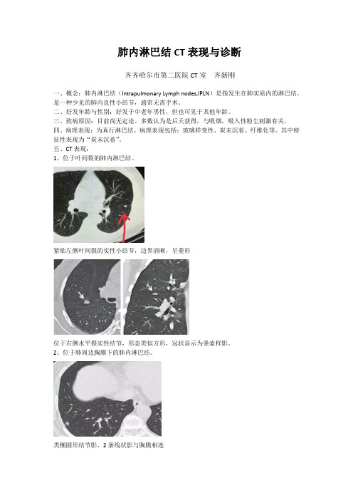 肺内淋巴结CT表现与诊断