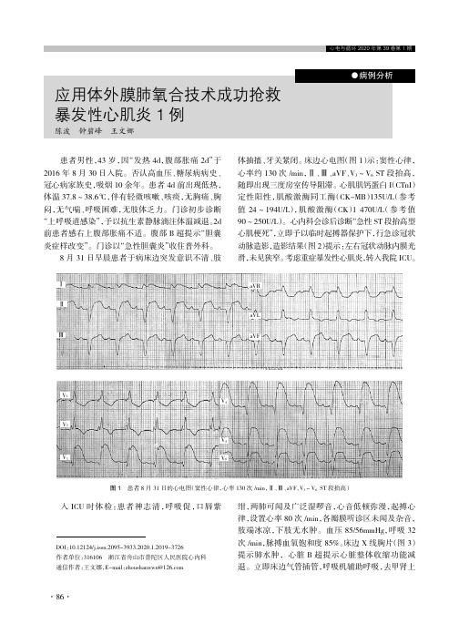 应用体外膜肺氧合技术成功抢救暴发性心肌炎1例