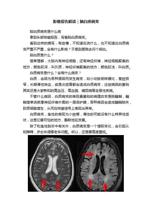 影像报告解读｜脑白质病变