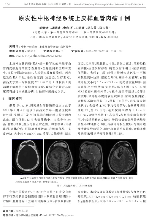 原发性中枢神经系统上皮样血管肉瘤1例