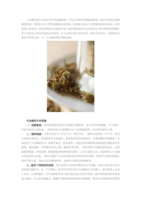 防止牛皮癣复发的预防措施