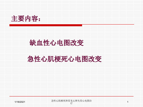 急性心肌梗死和常见心律失常心电图诊疗培训课件