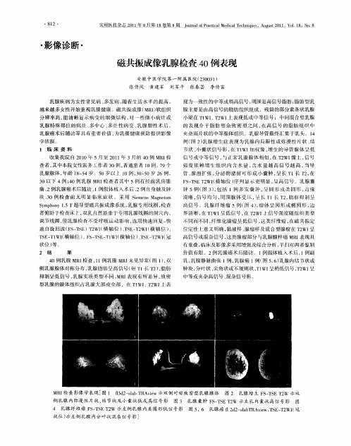 磁共振成像乳腺检查40例表现