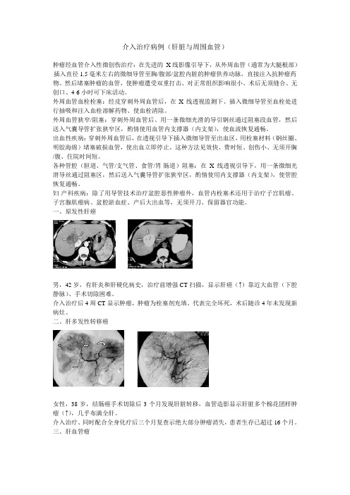 介入治疗病例(肝脏与周围血管)