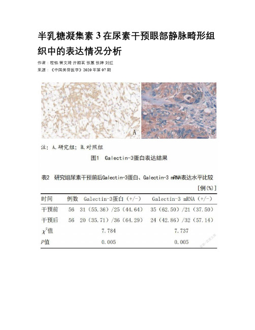 半乳糖凝集素3在尿素干预眼部静脉畸形组织中的表达情况分析