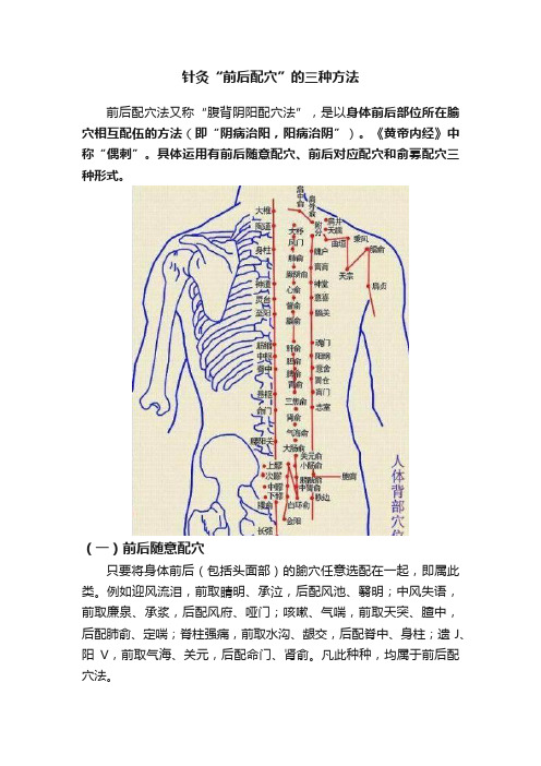 针灸“前后配穴”的三种方法