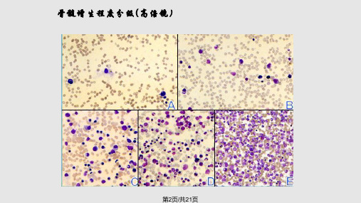 骨髓象检查的步骤与方法.pptx