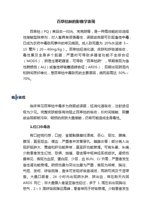 百草枯肺的影像学表现