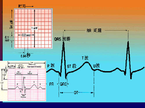 冠心病的心电图诊断及鉴别PPT课件