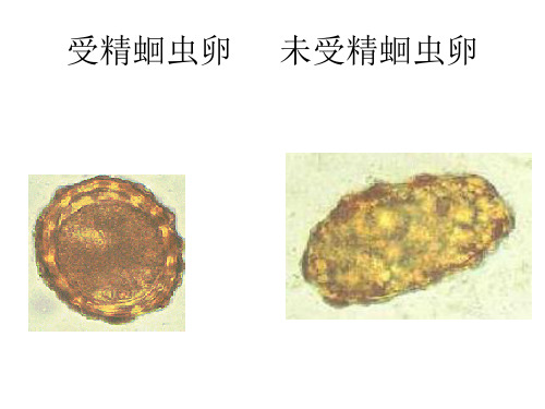 人体寄生虫学实验切片复习