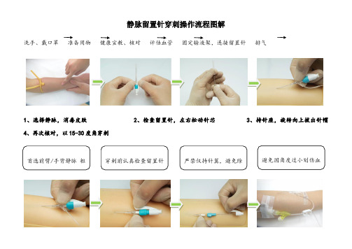 静脉留置针穿刺、冲封管及拔管图解流程