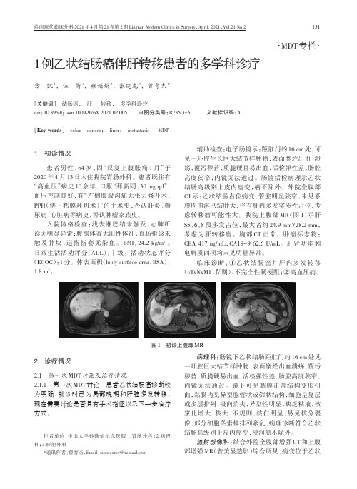 1例乙状结肠癌伴肝转移患者的多学科诊疗