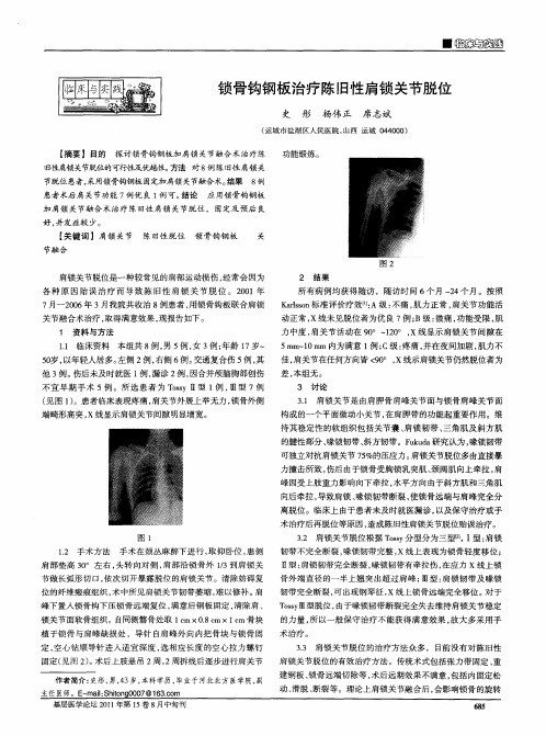 锁骨钩钢板治疗陈旧性肩锁关节脱位