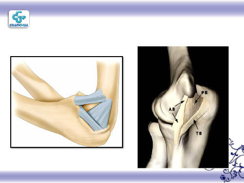 肘关节MRI诊断第二部分课件