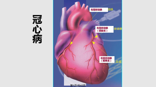 冠心病康复治疗及指导PPT课件