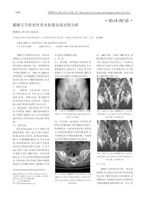 骶髂关节致密性骨炎影像表现对照分析_郭树农