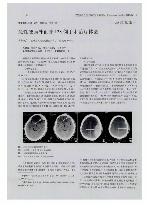 急性硬膜外血肿128例手术治疗体会