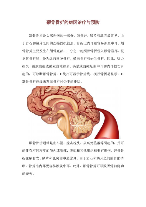 颞骨骨折的病因治疗与预防