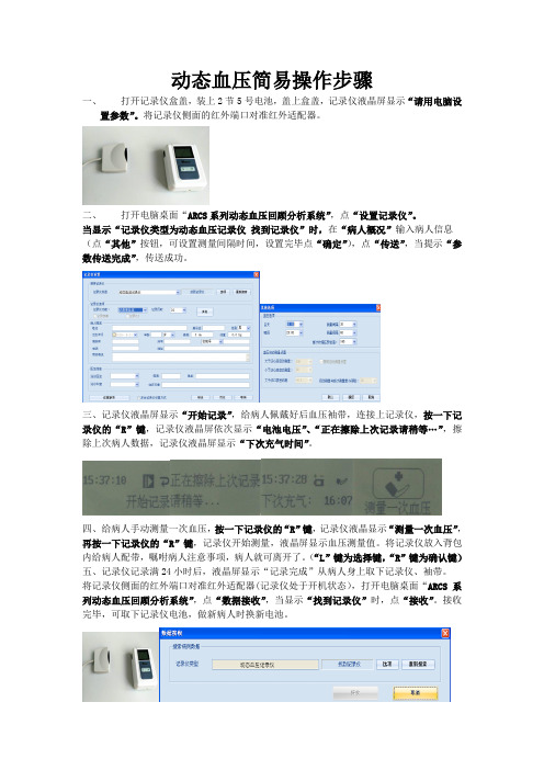 动态血压教程存档