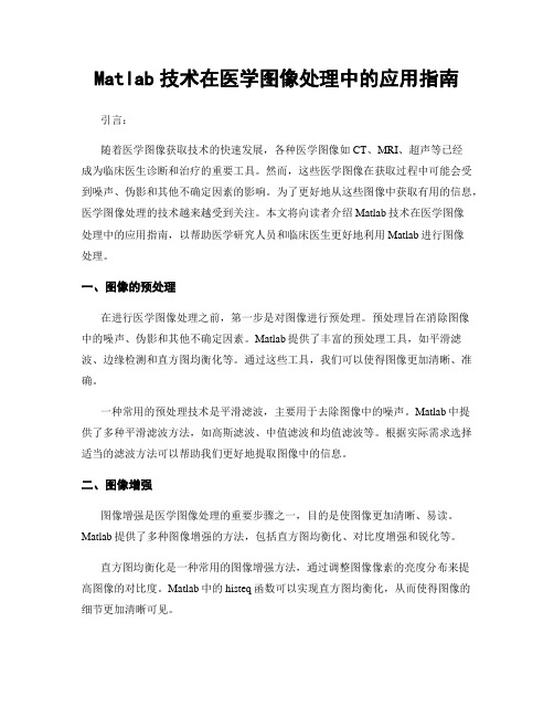 Matlab技术在医学图像处理中的应用指南