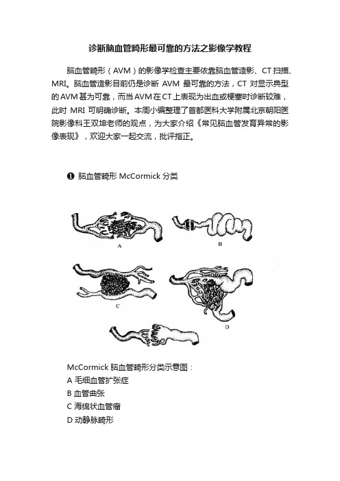 诊断脑血管畸形最可靠的方法之影像学教程