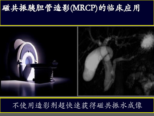 磁共振胰胆管造影(MRCP)的临床应用  ppt课件