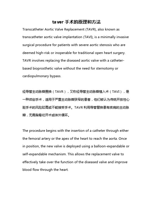 taver手术的原理和方法