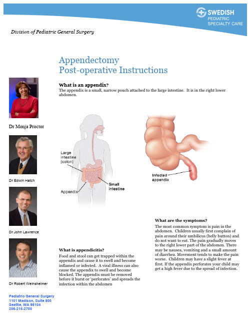 appendectomy