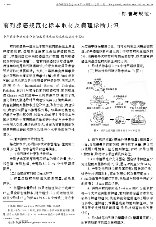前列腺癌规范化标本取材及病理诊断共识-云南医学会