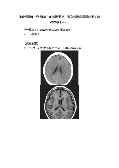 [神经影像]“克-雅病”的诊断要点、鉴别诊断和误区防范（建议收藏）~~~