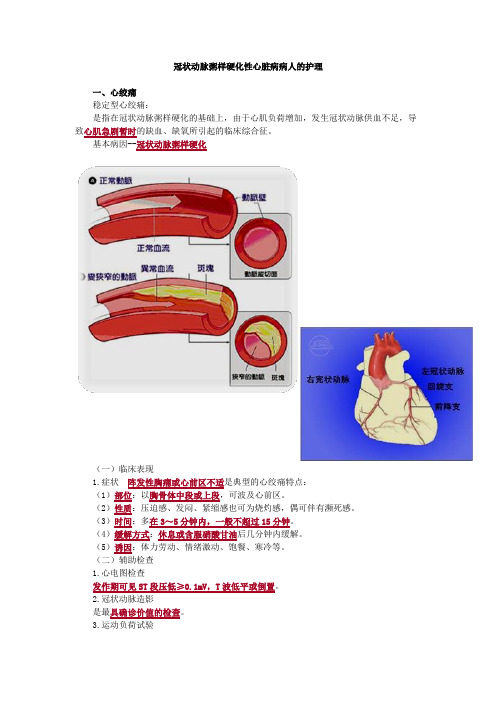 内科护理学-冠状动脉粥样硬化性心脏病病人的护理考点汇总