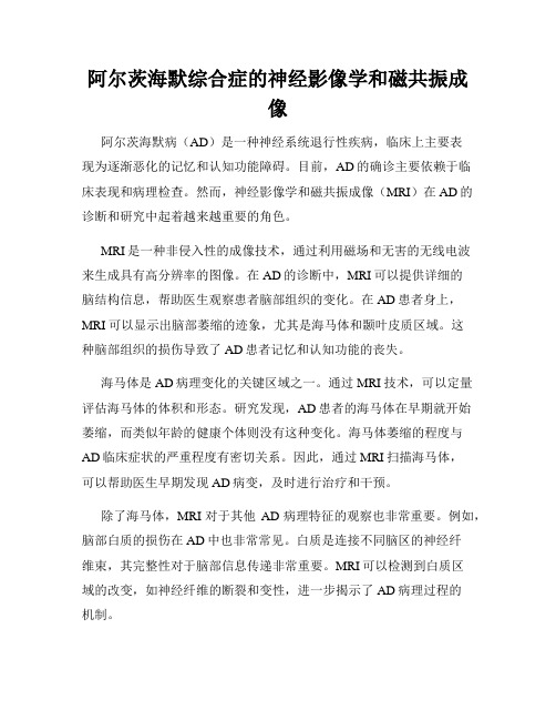 阿尔茨海默综合症的神经影像学和磁共振成像