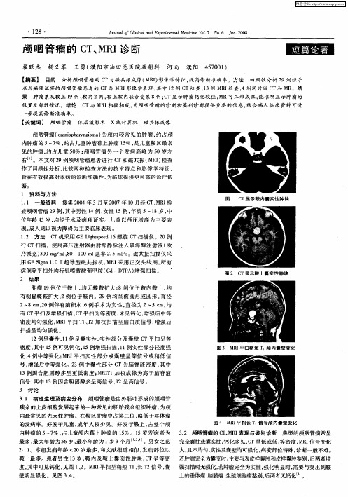 颅咽管瘤的CT、MRI诊断