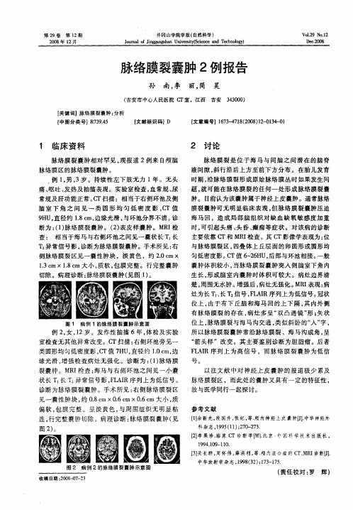 脉络膜裂囊肿2例报告