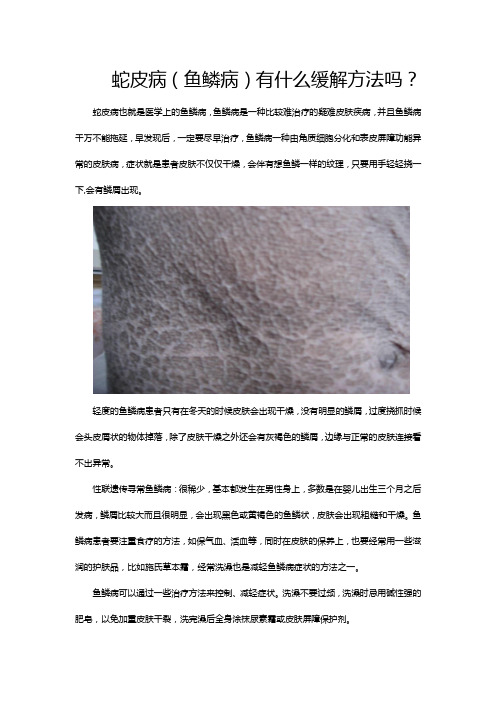 蛇皮(鱼鳞)有什么缓解方法吗？