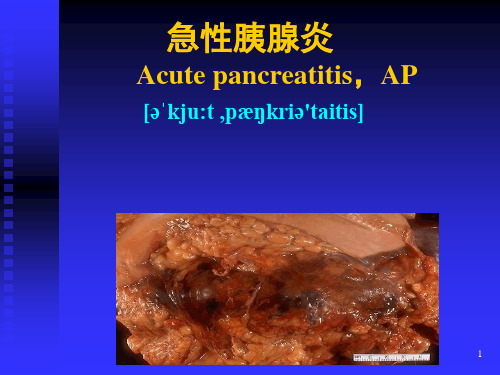 急性胰腺炎ppt课件 (2)