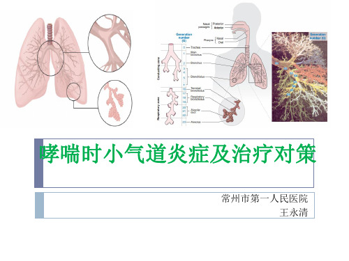 哮喘小气道炎症(科内稿)