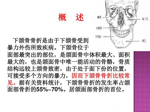 下颌骨骨折的护理查房