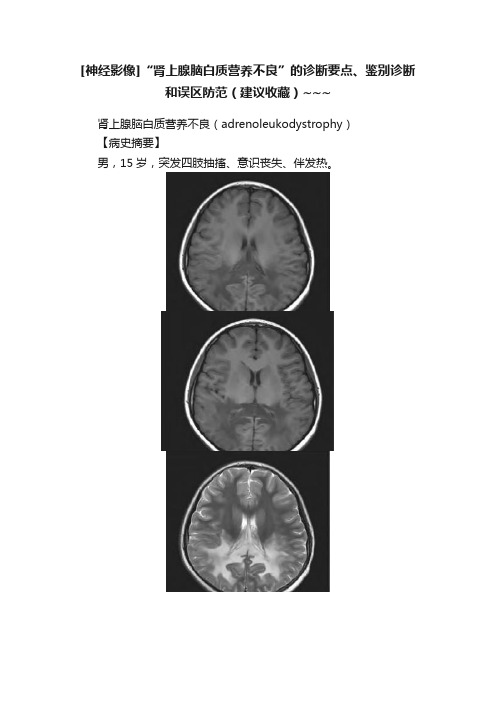 [神经影像]“肾上腺脑白质营养不良”的诊断要点、鉴别诊断和误区防范（建议收藏）~~~