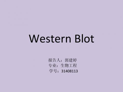 westen blot(蛋白免疫印记)