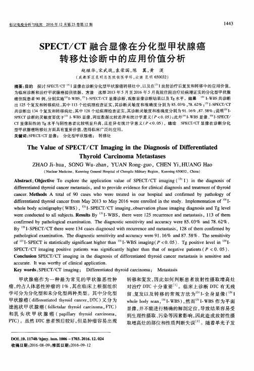 SPECT/CT融合显像在分化型甲状腺癌转移灶诊断中的应用价值分析