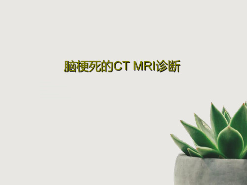 脑梗死的CT MRI诊断124页PPT