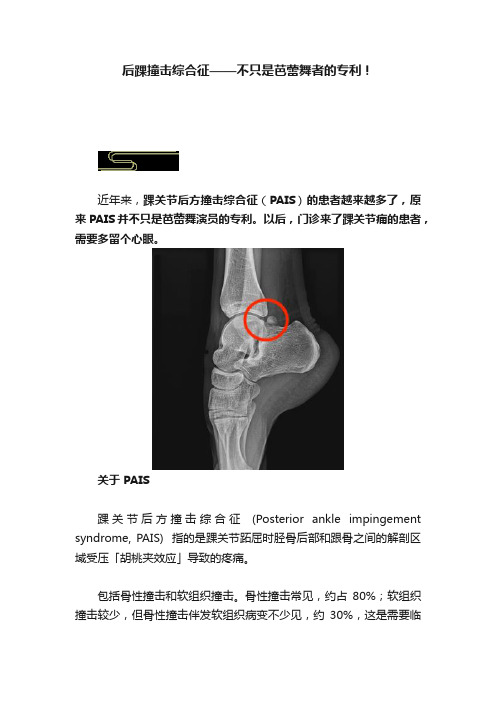 后踝撞击综合征——不只是芭蕾舞者的专利！